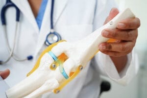 Knee osteoarthritis, Doctor showing model knee joint orthopedic.